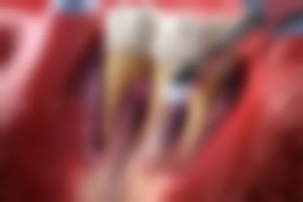 福州晨洁旭辉口腔门诊部2026年最新价目表，提供透明实惠的口腔护理服务
