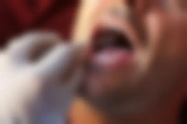 菏泽欧诺口腔门诊部口碑如何？对比曹县博仕口腔，哪家更值得选择？
