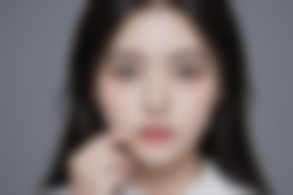 潘彦龙医生双眼皮修复为什么这么牛？