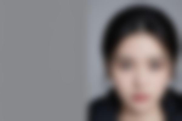 武汉医院曹玮医生眼整形和修复技术解析，20年经验值得信赖！