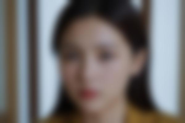 刘海涛医生玻尿酸价格多少钱？