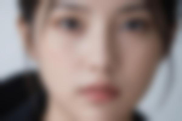何晓娅医生鼻整形技术有多牛？