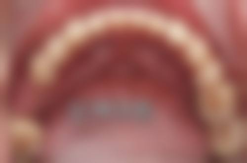 深圳哪里看牙齿好的医院？同步齿科（深圳连锁）——便捷服务典范