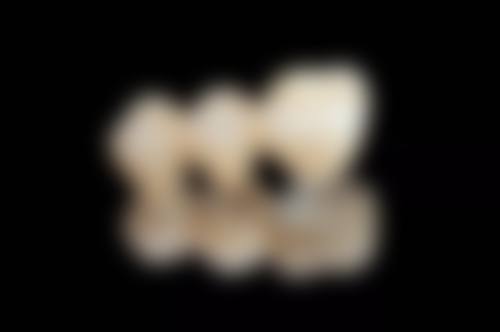 四、山西众植齿科医院威兰德全瓷冠项目口碑和评价及手术成效反馈