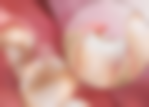 韩国登腾种植牙效果如何？成功率超90%适配性高，4000-8000元性价比之选！