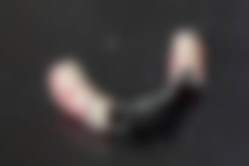 种植牙与搭桥修复的材料对比