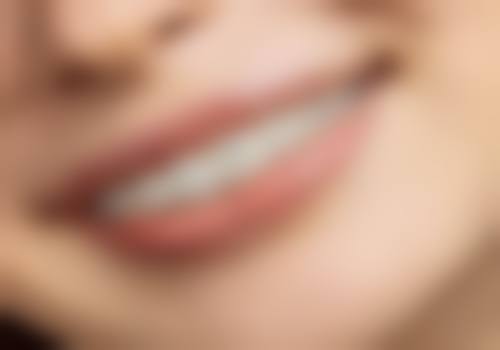 唇腭裂牙齿分阶段矫正的适合人群有哪些？