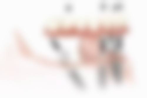 五、在实际操作中，种植牙修复后注意事项更适合哪些人？