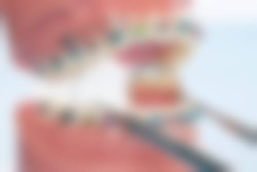 二、种植牙修复后注意事项通常在什么阶段被纳入医疗选择范围？