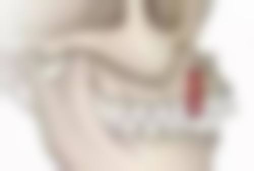 十一、在决定种植牙修复后注意事项前，普通用户更容易忽略的关键信息