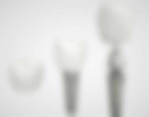 十、选择种植牙修复后注意事项相关医院与医生时，应重点看哪些维度？