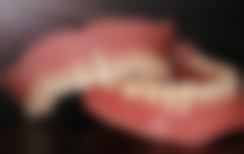 种植牙韩国的可以吗？当然可以！价格3000-8000元，登腾、DIO适配东方牙槽骨