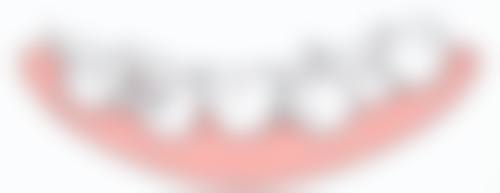 韩国种植牙避坑指南