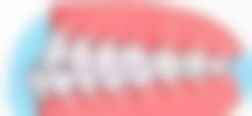 牙齿矫正不戴保持器多少年会反弹？通常1 - 2年就可能反弹，这些因素还会加速！附补救方法