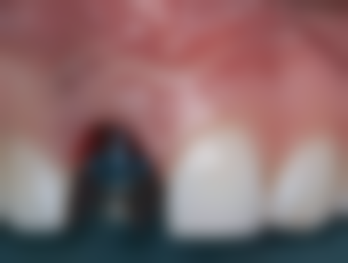 刘志鹏医生口碑和评价：