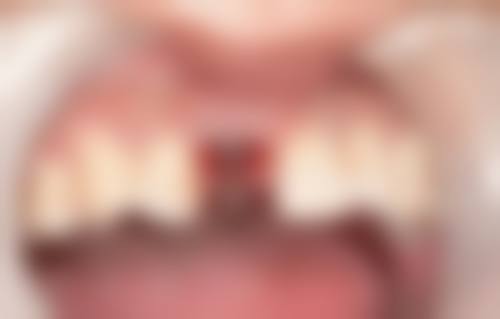 刘志鹏医生收费价格：