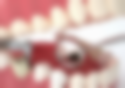 干燥综合征种植牙常见并发症或后遗问题，在临床中如何理解其发生概率