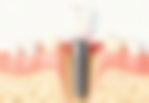 刘志鹏医生擅长项目：