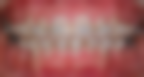 牙齿矫正怎么选择医院医生及国内医院医生推荐？