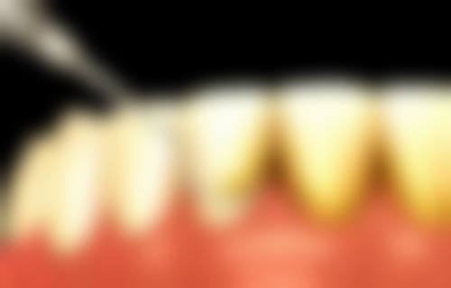 刘亚娟医生擅长项目