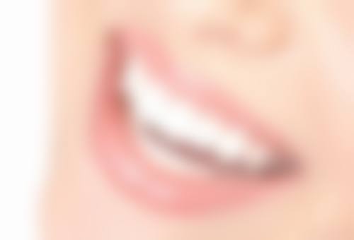 七、东莞大岭山新牙爱美口腔门诊部患者常见问题