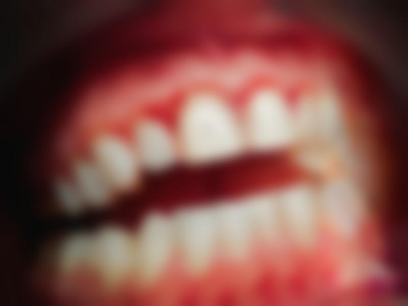 材料与工艺保护