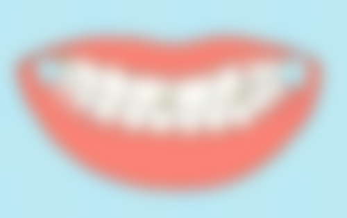 种植牙和烤瓷牙哪个好一些？种植牙稳定性高寿命长，单颗价格3000元起，烤瓷牙价格低但易磨损！90%牙医推荐种植牙，韩国奥齿泰种植体仅需5980元！