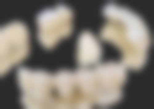 种植牙和烤瓷牙怎么选择医院医生及国内医院医生推荐？