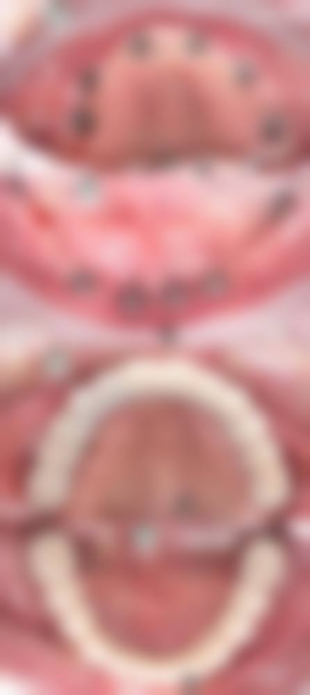 四、济南市中洁雅口腔诊疗项目