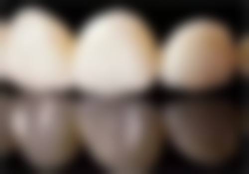 拔牙后矫正牙齿是什么?通常在什么医学背景下被选择?