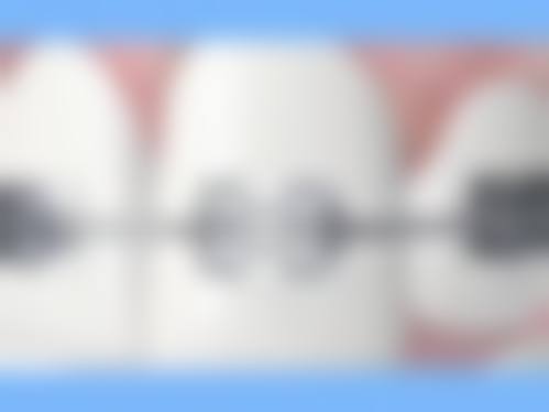 马秀银医生收费价格：