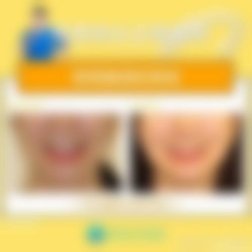 五、在实际操作中，未换牙的儿童根管治疗更适合哪些人？