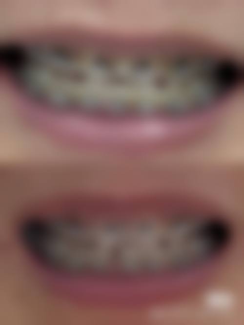 深圳正夫口腔(宝安中 心店)正规资质及靠谱实力