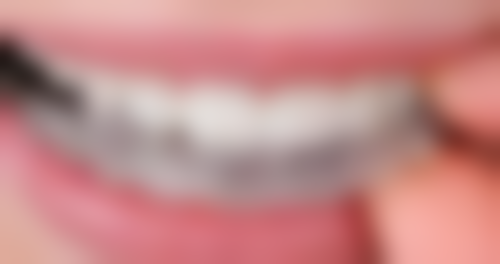 六、拔牙以后种植牙所依赖的技术 / 材料，现实优势与限制并存