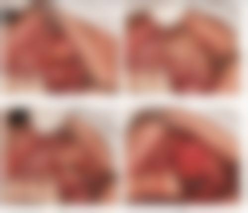 二、霍光耀医生擅长项目介绍