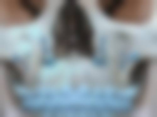 三、朱凌兰医生做手术价格