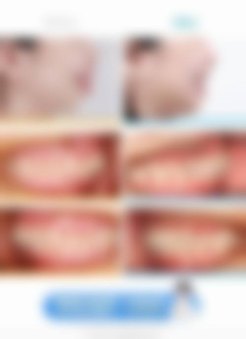 陕西莲湖桃园北路口腔口腔治疗实例参考