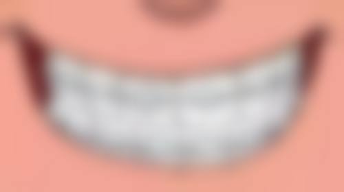 哪些人，全口种植牙风险显著更高