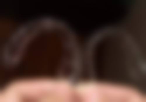 牙齿矫正适合哪些人?山医 大一院正畸科适合人群指南