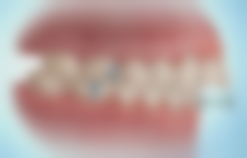 技术方案对价格的影响