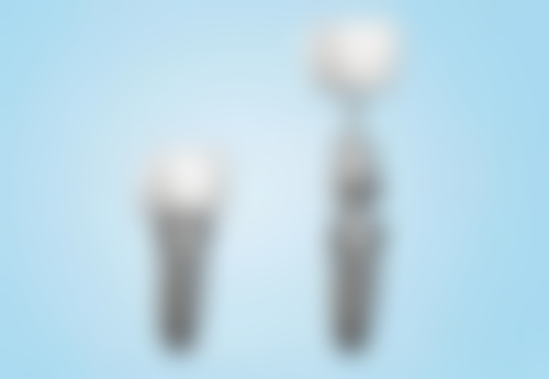 种植牙价格与成效、风险的关系