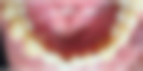 王文刚医生预约挂号指南