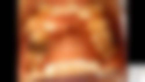 三、苏志远医生技术水平高吗