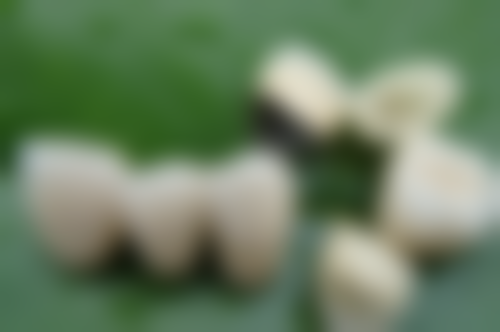 二、郑佳雄擅长项目及优势