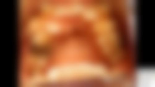 六、东莞芽豆口腔口腔项目价格参考