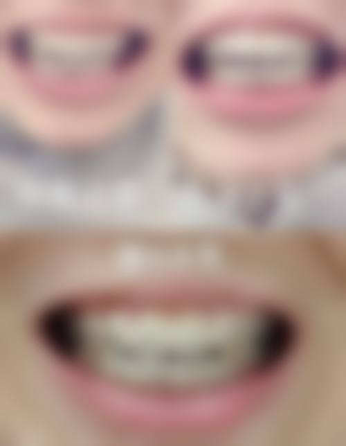 3. 儿童口腔治疗体验