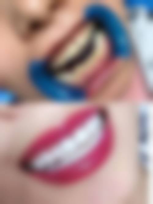 白若飞医生擅长项目：