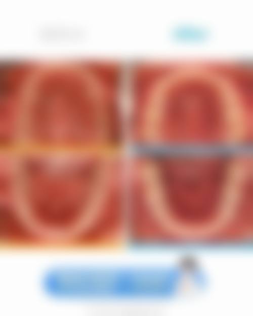 珠海六和口腔医院种牙好吗，有啥技术优势？