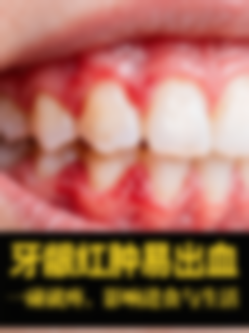 儿童龋齿补牙后进食时间：树脂1小时可吃，银汞合金100-300元，24小时后吃饭