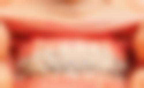 8岁儿童拔牙的风险评估：儿童拔龋齿有危险吗